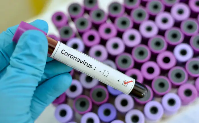 Coronavirus 696x430 1