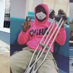 Davido leg injury