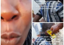 They Are Still Shooting at Lekki This Morning – DJ Switch Says As She Shares Video of a Gunshot Victim