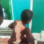 Angry 14-year-old boy sets boy, 10, ablaze at Amanfrom