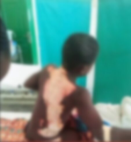 Angry 14-year-old boy sets boy, 10, ablaze at Amanfrom