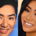 Nikita Dragun Plastic Surgery Journey — Before and After