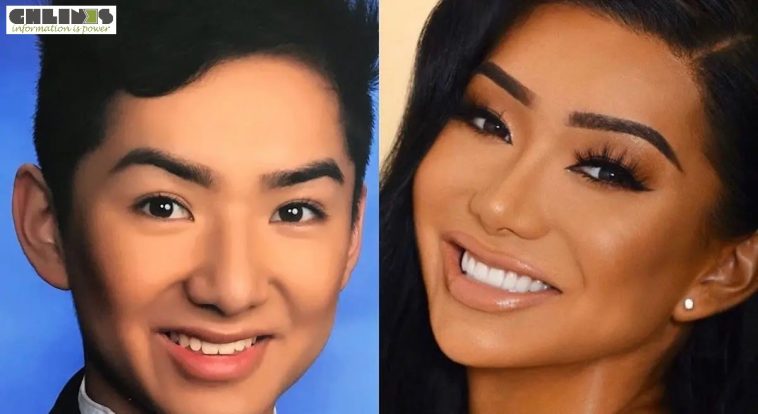 Nikita Dragun Plastic Surgery Journey — Before and After