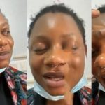 Girls please stop using contacts – Nigerian lady cries out after contact lens made her partially blind (Video)