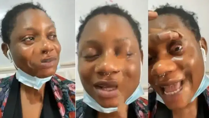 Girls please stop using contacts – Nigerian lady cries out after contact lens made her partially blind (Video)