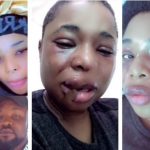 Lady who often shows off her boyfriend shares clip of her bruised face after alleged assault (Video)