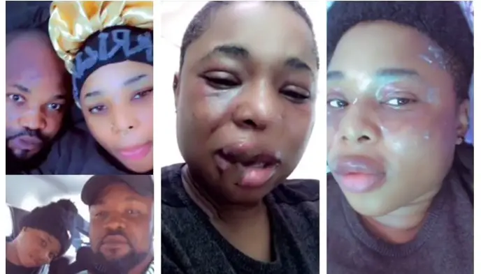 Lady who often shows off her boyfriend shares clip of her bruised face after alleged assault (Video)